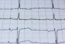 vortex growth beam technology